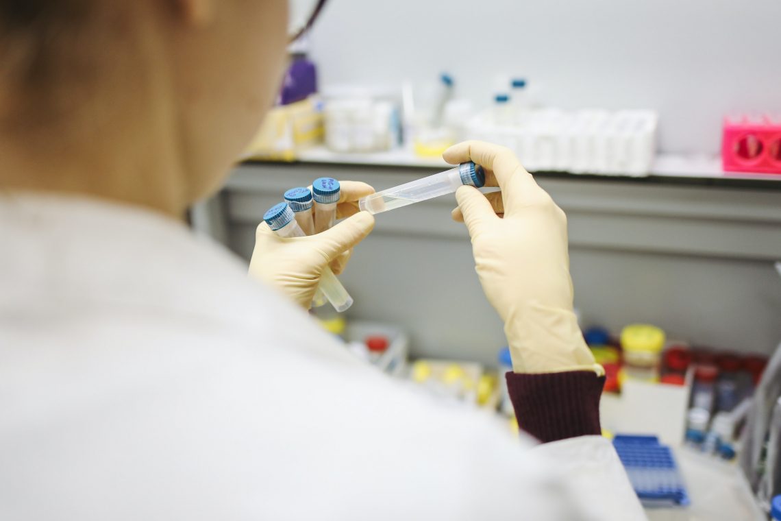 V ponedeljek potrdili 388 okužb z novim koronavirusom