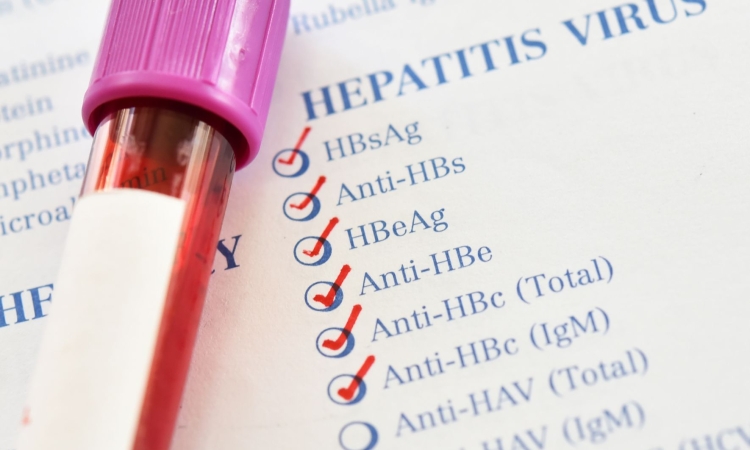Hepatitis D uradno razglašen za rakotvornega